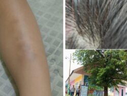 Diduga Alami Bullying di TK Bhayangkari Mangkutana, Anak Usia 6 Tahun Luka dan Trauma Sekolah